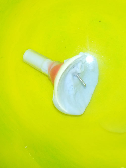 Motility Coupling Post, Artificial Eye Centre In Delhi, Best Ocularist in delhi