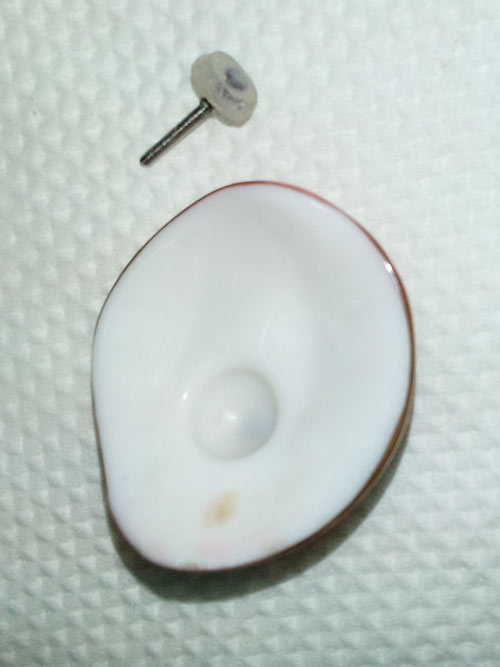 Motility Coupling Post, Artificial Eye Centre In Delhi, Best Ocularist in delhi
